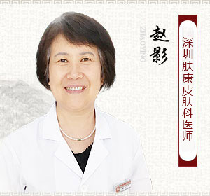 赵影